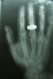 hand